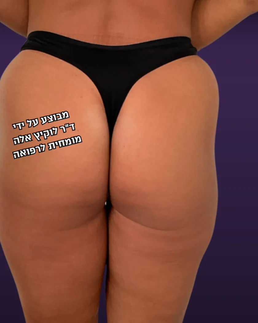 לפני הטיפול, הישבן, מבט מאחור