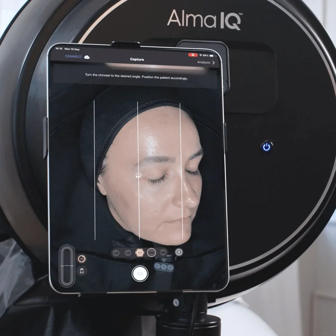 מערכת האבחון Alma IQ, ועל הטאבלט צילום של פנים בזמן סריקה